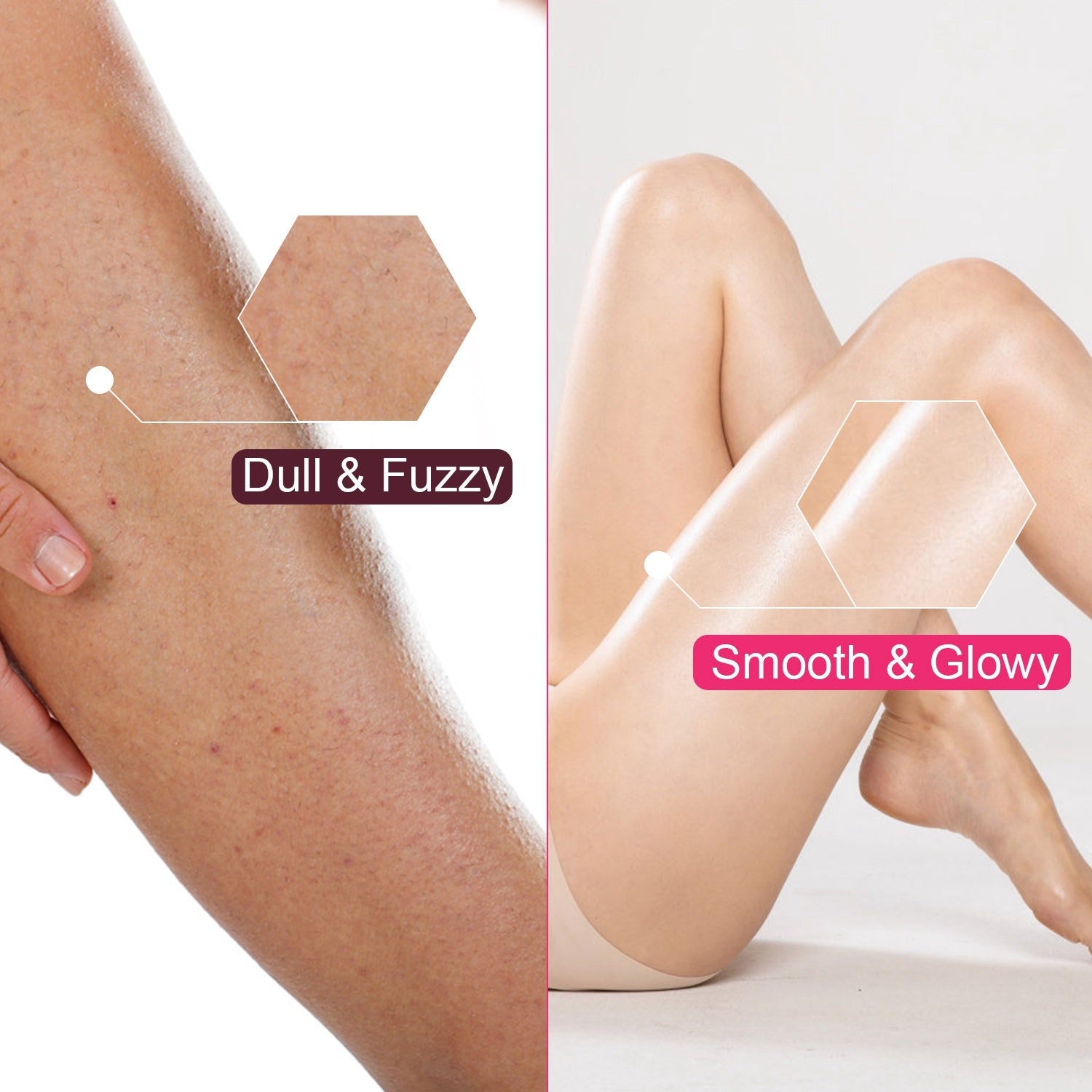 Comparison of dull and fuzzy skin on one leg with smooth and glowing skin on another leg.